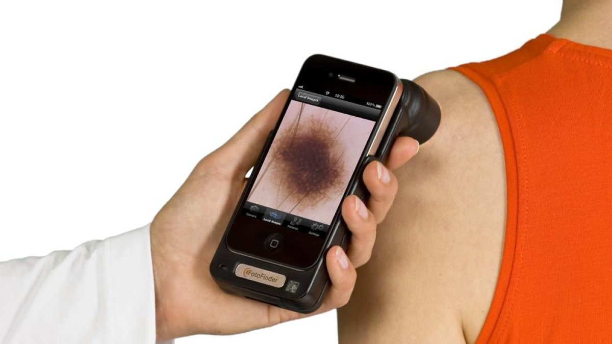 Salut implanta la teledermatologia als CAP que deriven al Joan XXIII