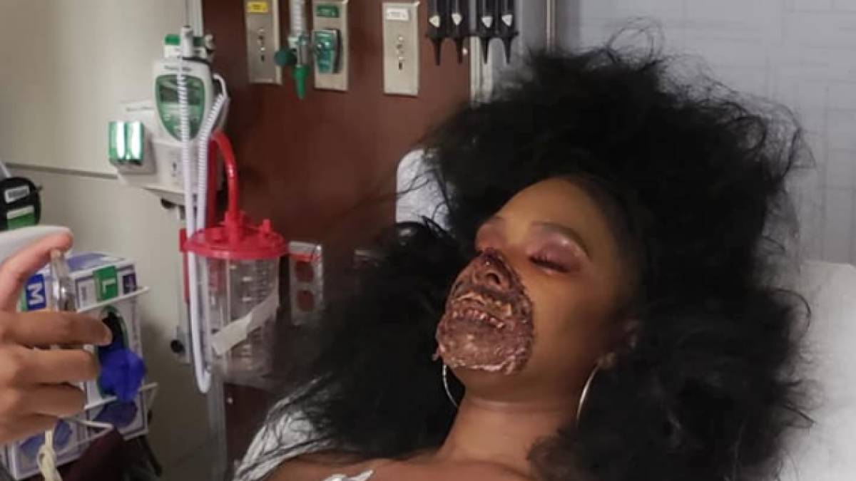 Acaba en el hospital después de que los médicos pensaran que el maquillaje de zombi que llevaba|traía era real