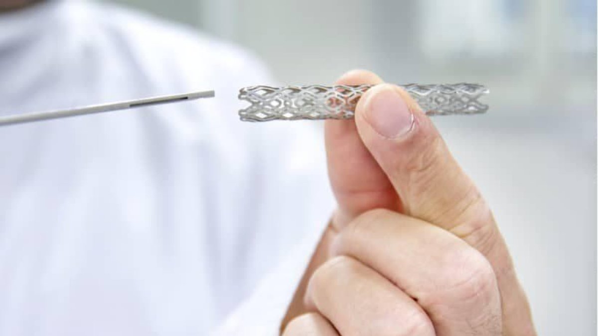 Els «stents», l'aparell pel cor que genera un 80% més de probabilitats de patir un infart