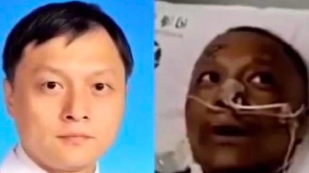 Mor un dels metges xinesos que es va tornar negre per un tractament contra el coronavirus