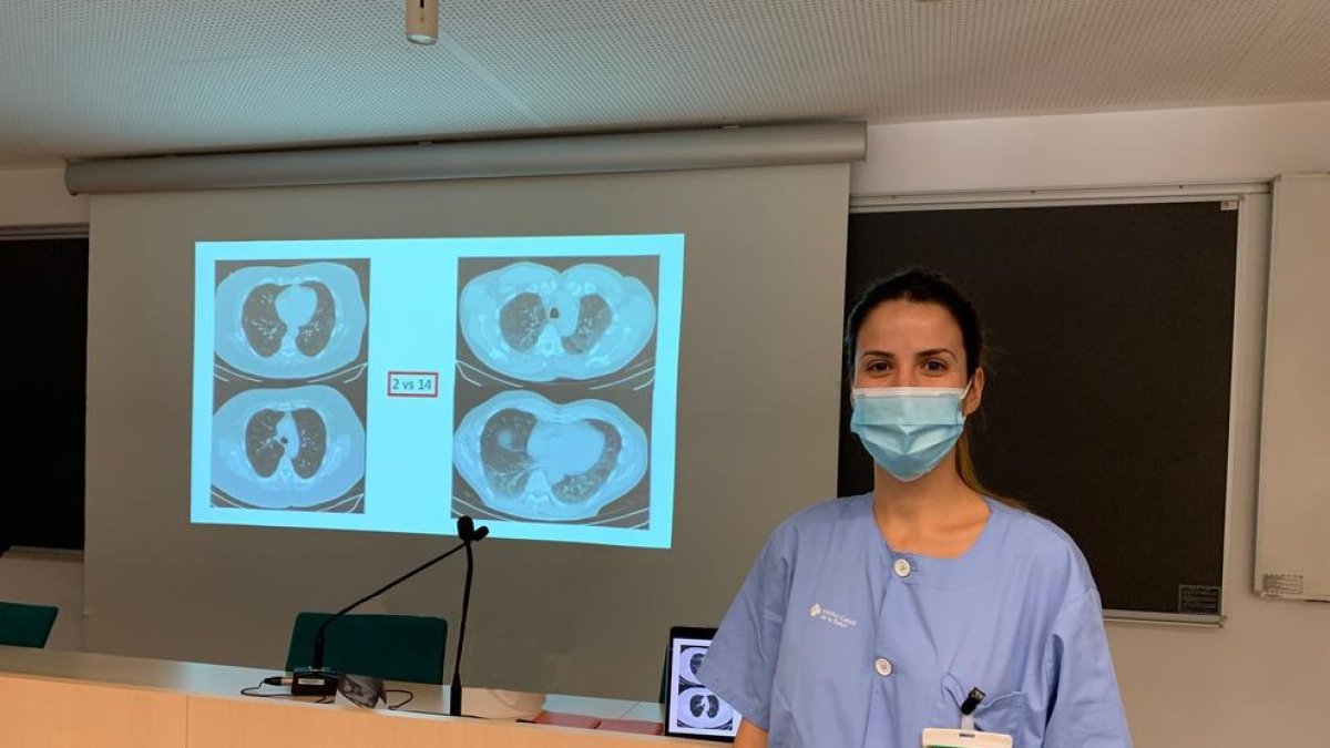 El 84% dels pacients amb covid ingressats a l'UCI tenen problemes respiratoris als 3 mesos de l'alta