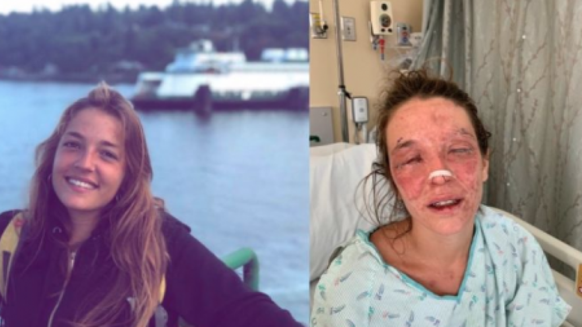 10.000 personas dan 200.000 € en 24 horas para ayudar a joven de Terrassa