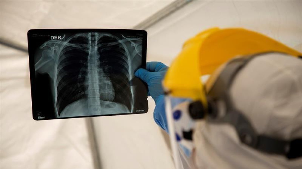 Aconsegueixen detectar la covid amb una radiografia de tòrax, aplicant intel·ligència artificial
