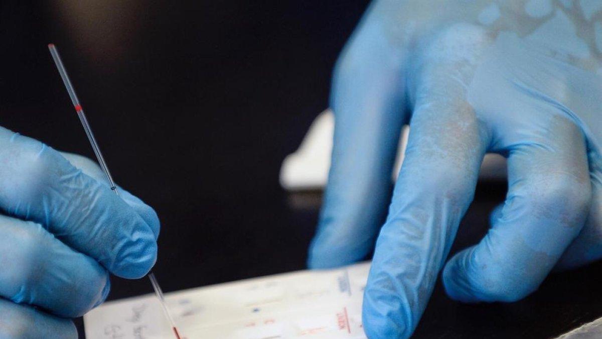 Una prueba cutánea como alternativa a los test de anticuerpos