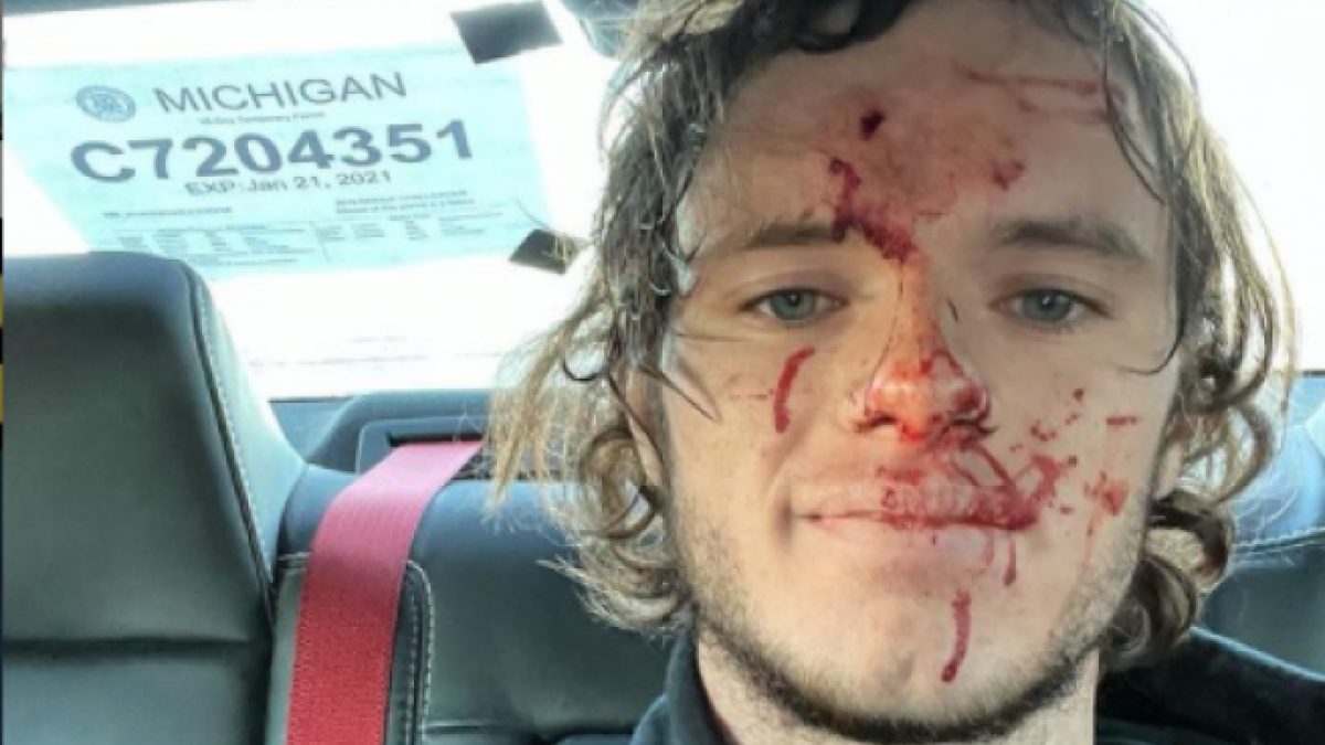 Un 'youtuber' acaba hospitalizado después de dispararse accidentalmente en la cabeza