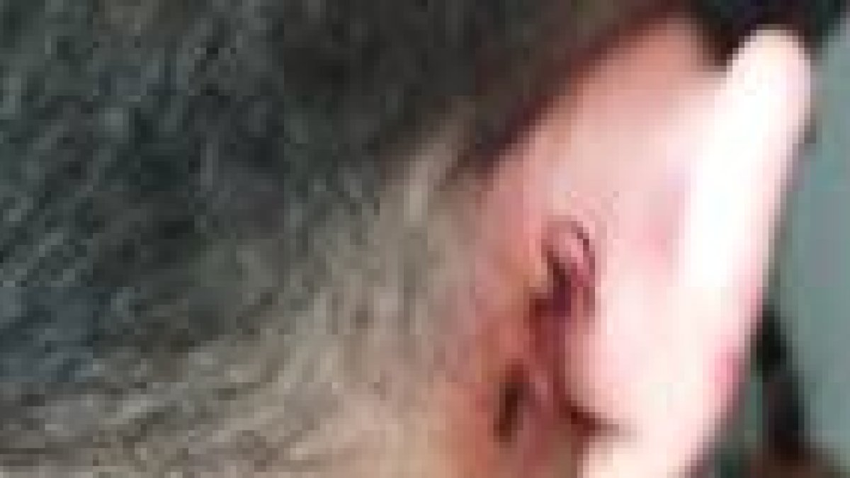 Denuncien l'agressió d'un menor a un noi amb una pedra al barri de la Granja