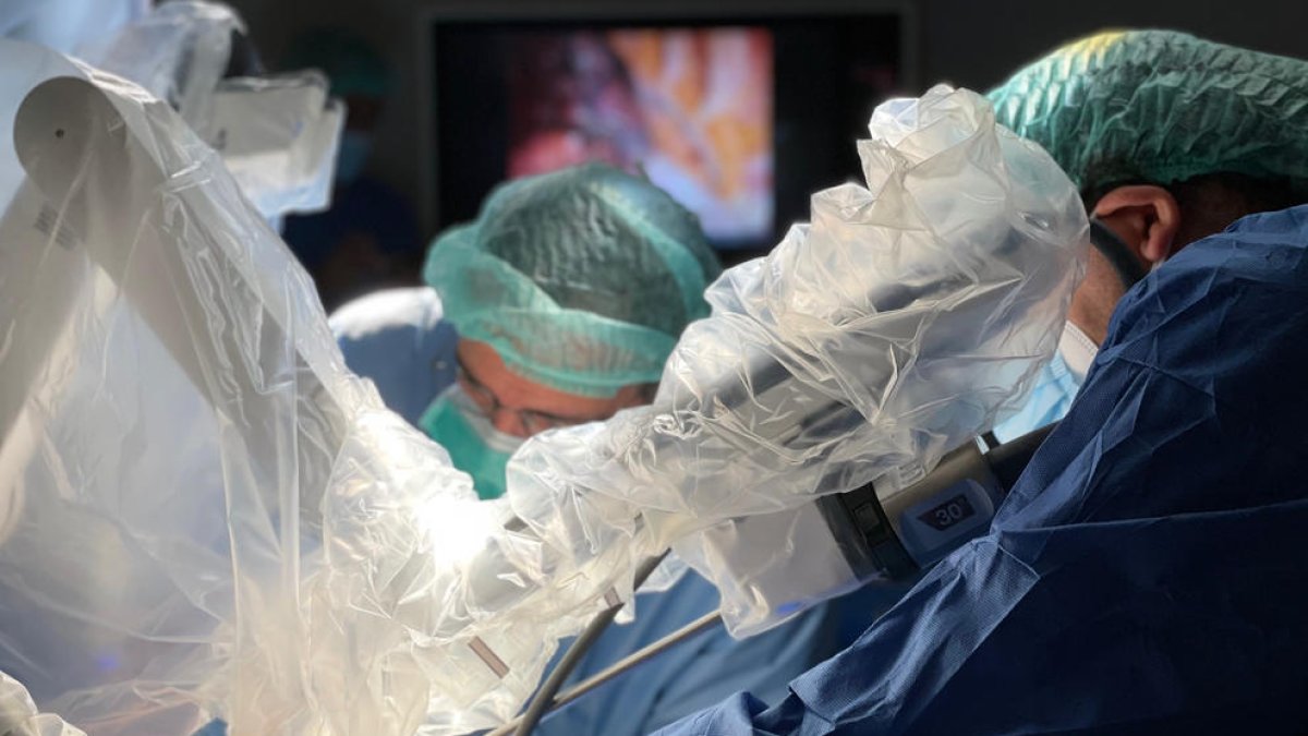 Hacen la primera extracción en el mundo de una primera chuleta|costilla con cirugía robótica y una sola incisión