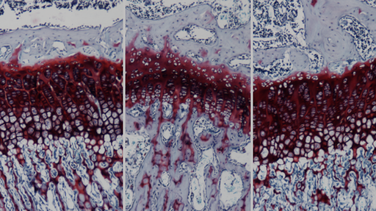 Investigadores de la UAB desarrollan una terapia génica que cura una enfermedad rara de los huesos