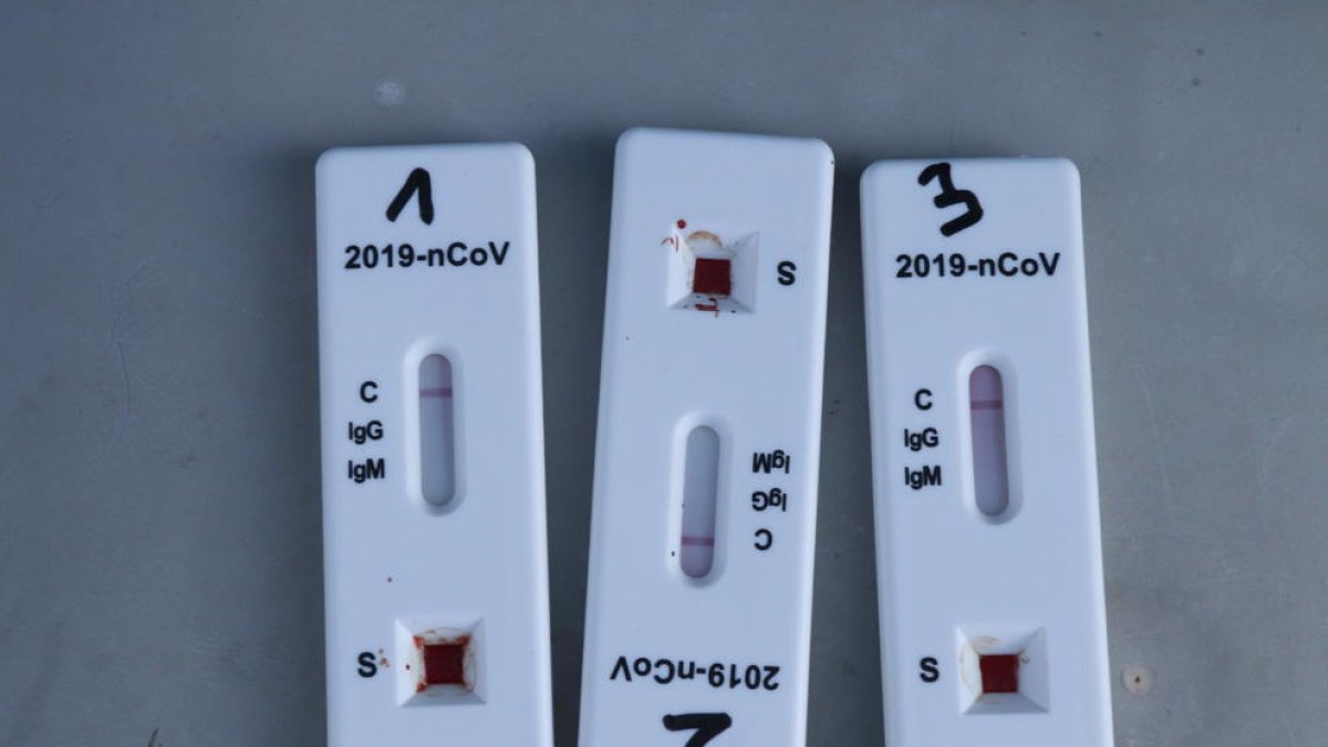 tests d'antígens, covid-19, pandèmia, coronavirus