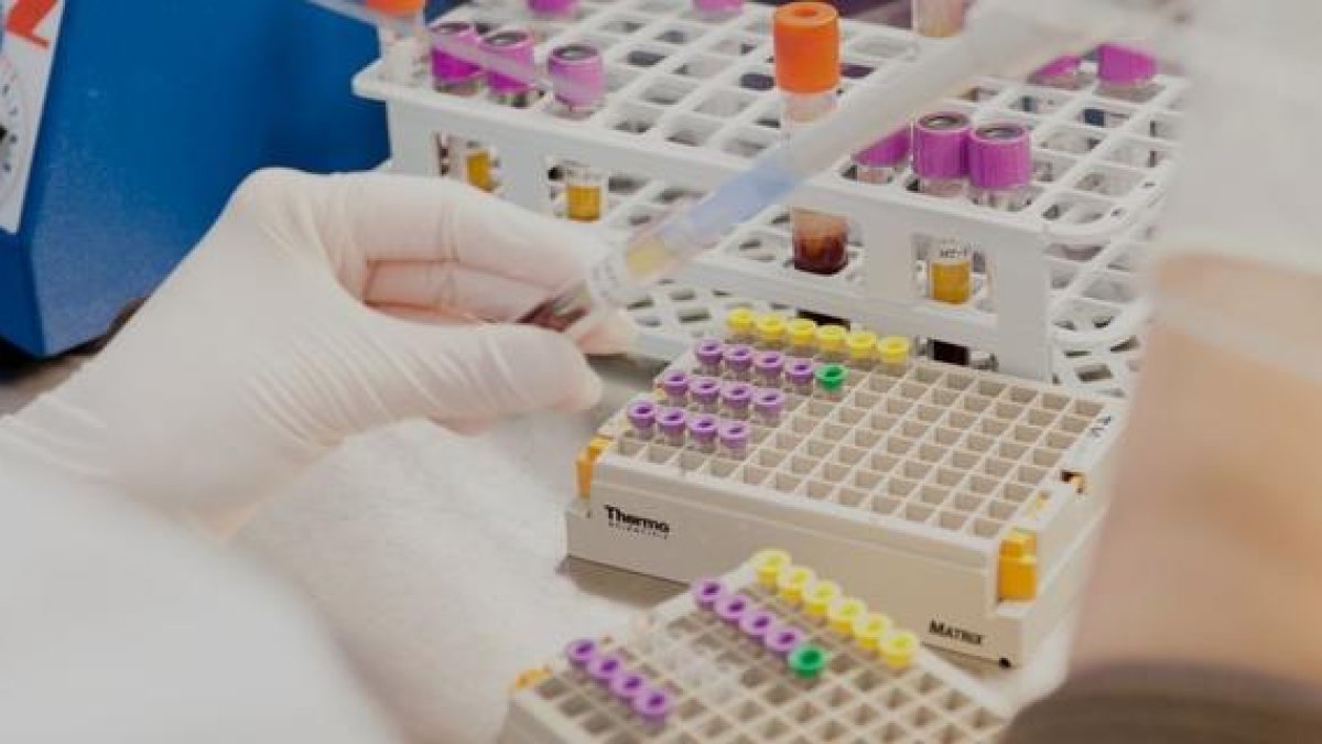 Descobreixen el mecanisme pel qual la vitamina D modula el sistema immune