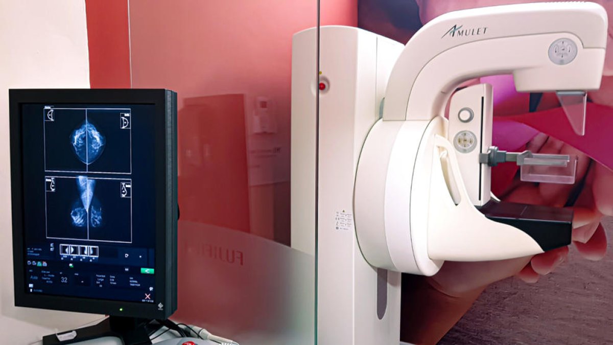 La Clínica Terres de l'Ebre incorpora nous aparells de radiologia d'última generació