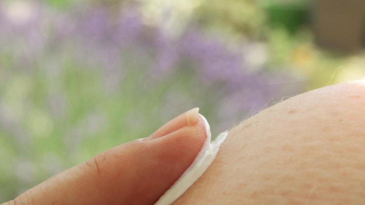 Estos son los mejores remedios caseros para aliviar las quemaduras solares