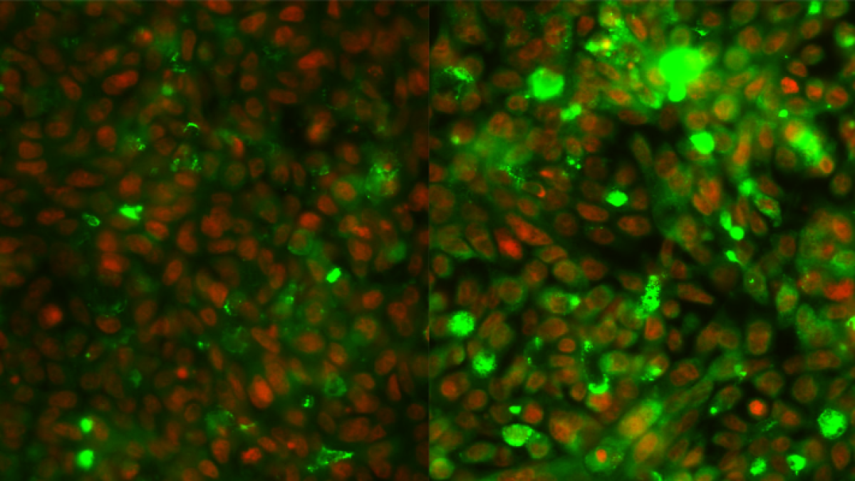 Descobreixen perquè els càncers colorectals resisteixen a l'acció dels fàrmacs