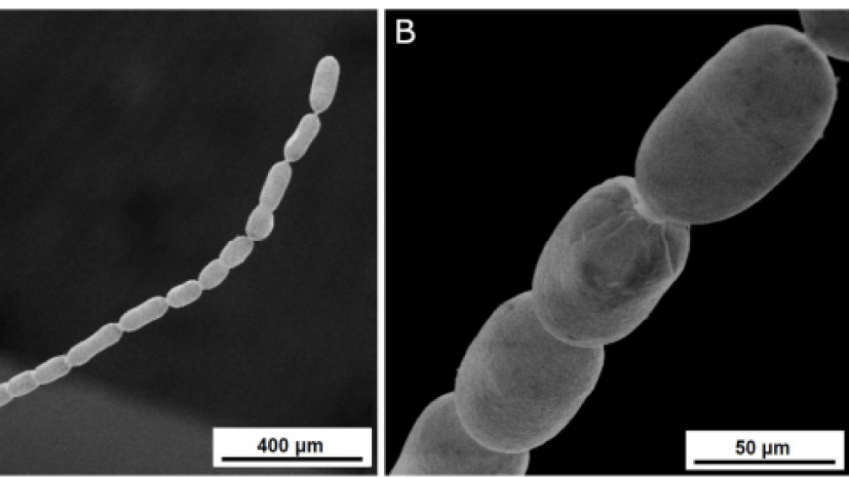 Descubren una bacteria gigante que es 5.000 veces mayor que la mayoría y se puede ver sin necesidad de microscopio