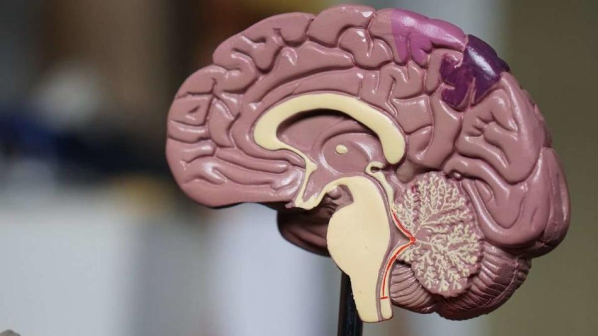 Els supervivents del limfoma de Hodgkin mostren més signes de demència primerenca