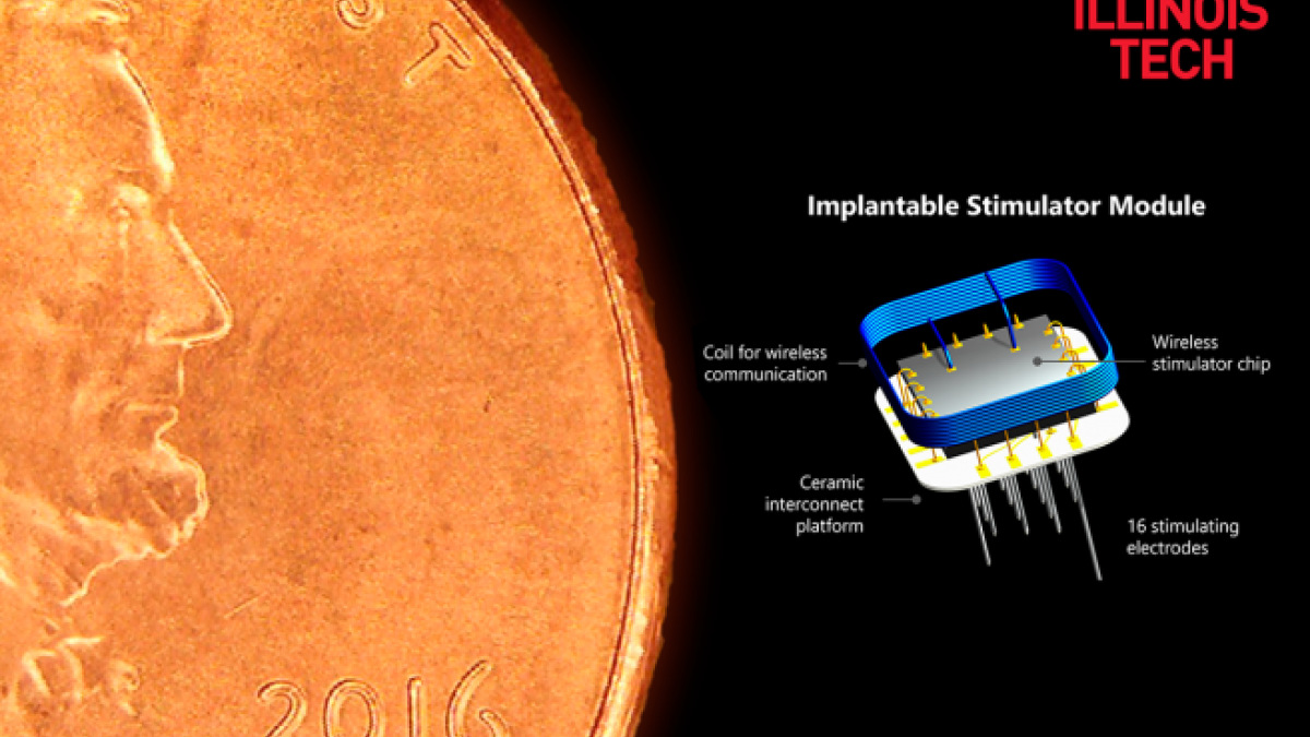 Elaboren el primer implant sense fils que retorna la vista a una persona cega