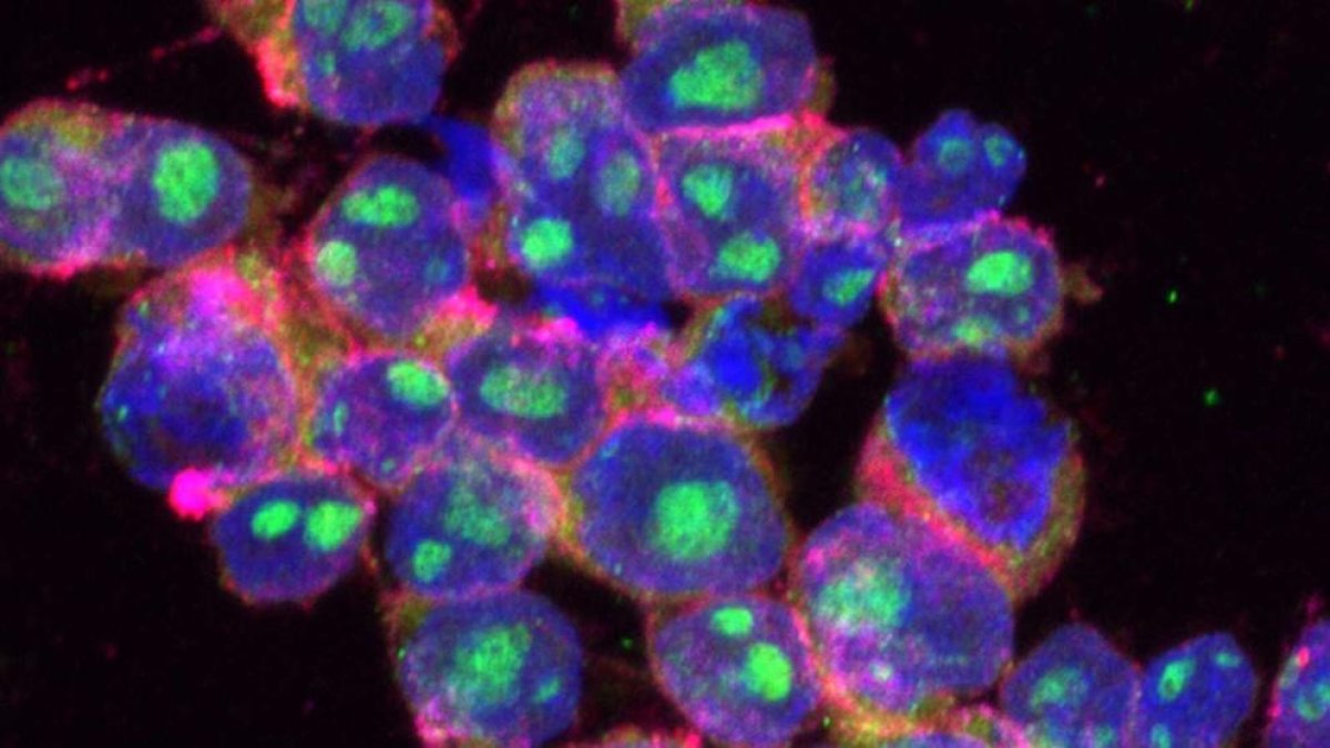 Crean nanocápsulas con control remoto para ampliar el efecto de las quimioterapias