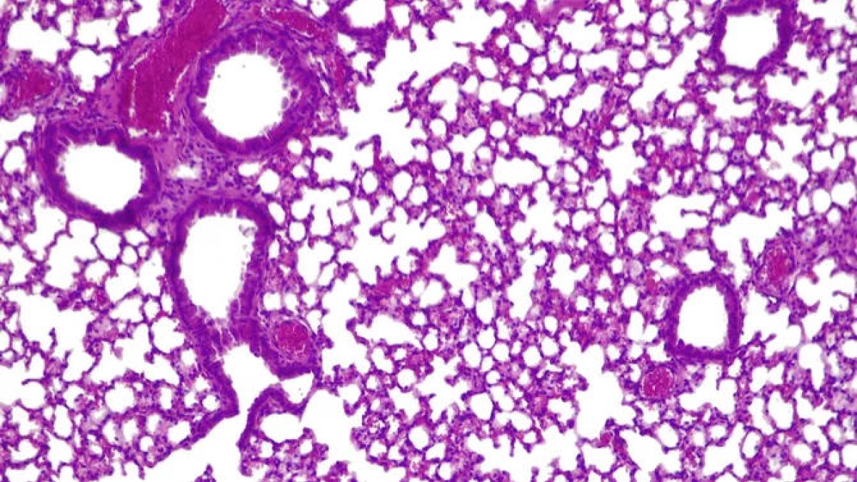 Creen una 'píndola viva' per combatre les infeccions pulmonars resistents als antibiòtics