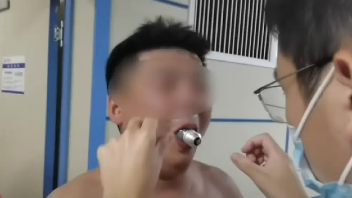 Un home acaba a l'hospital amb una bombeta embussada a la boca després d'intentar un repte viral d'internet