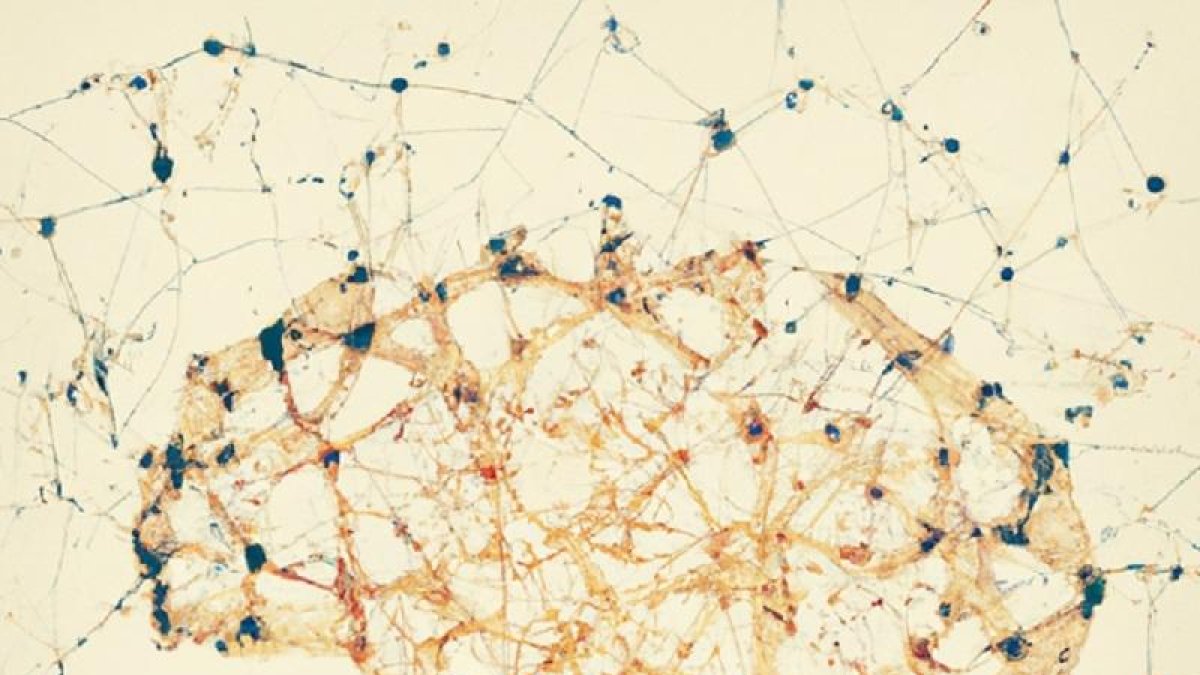 Descubren una proteína implicada en el desarrollo de la esquizofrenia