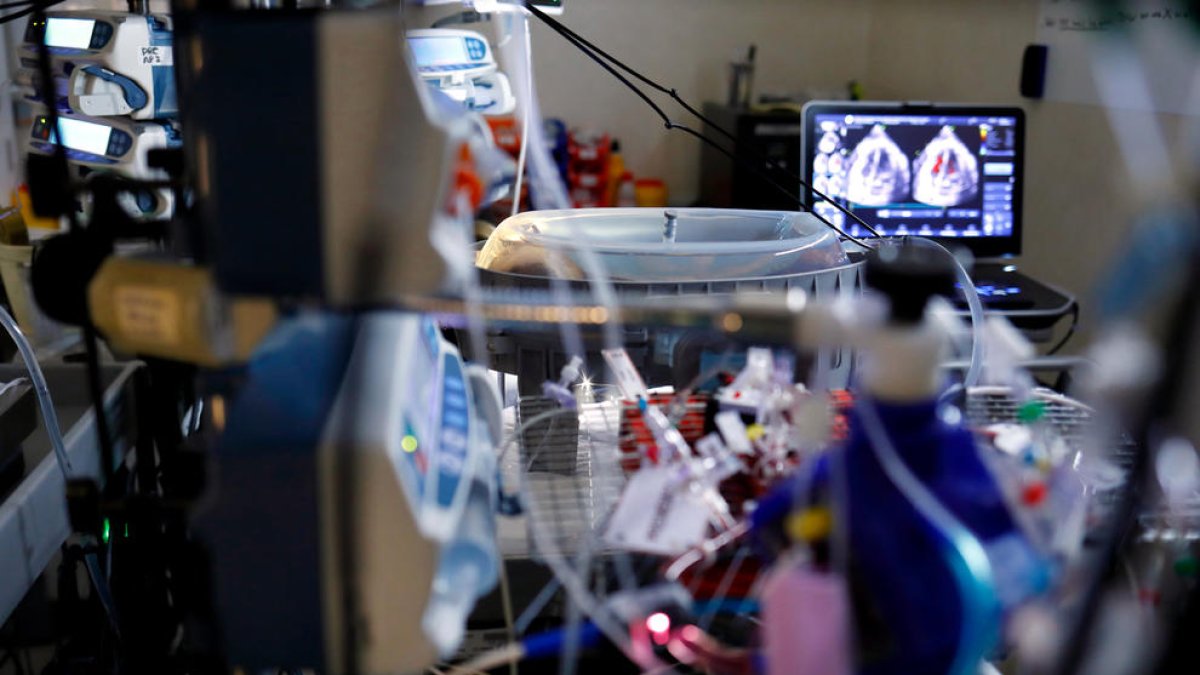 Investigadores catalanes consiguen que un feto de oveja sobreviva 12 días en una placenta artificial