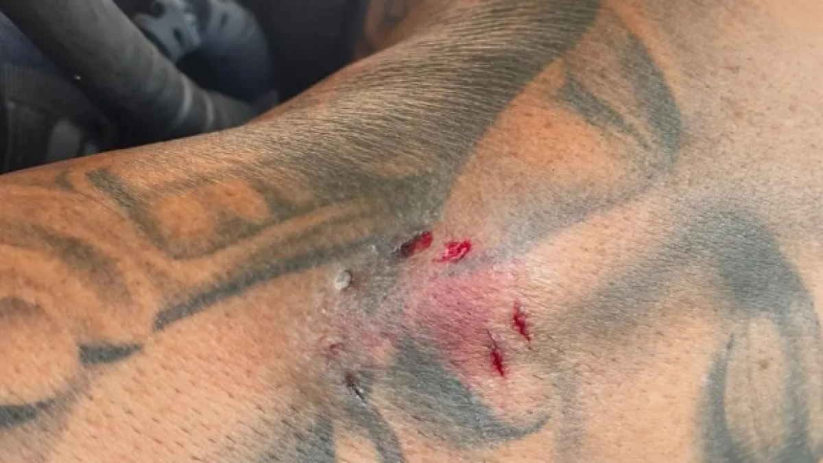 Mossega dos policies quan anava a ser detinguda per amenaçar i agredir al seu marit amb un ganivet