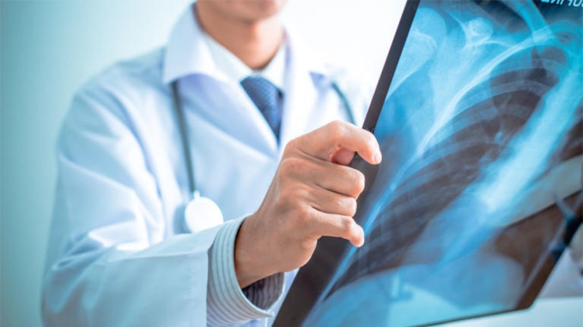 Una flora intestinal sana se relaciona con una mejor densidad ósea en los adultos mayores