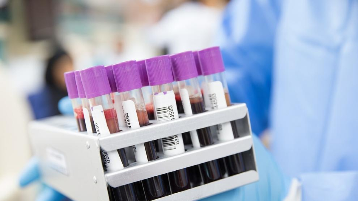 Desenvolupen un test de sang capaç de diagnosticar el trastorn bipolar