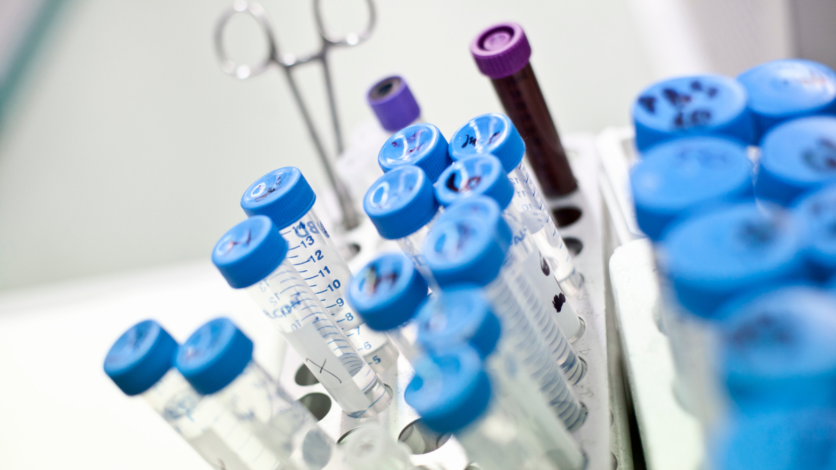Imagen de tubos con muestras
