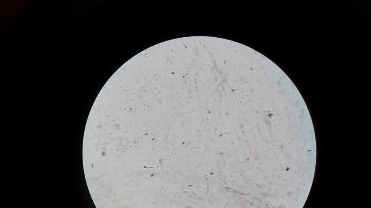 Imagen de esperma bajo un microscopio