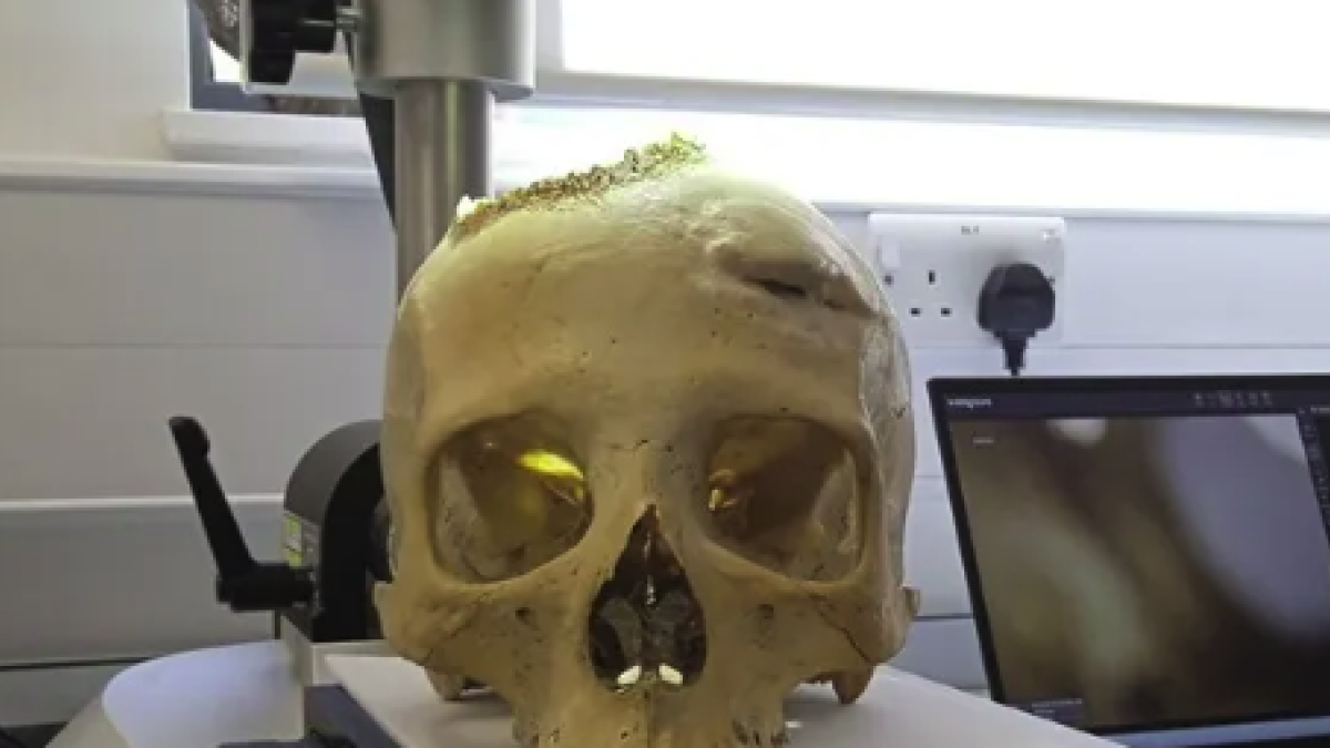 Els cranis es van examinar mitjançant anàlisi microscòpica i tomografia computaritzada.