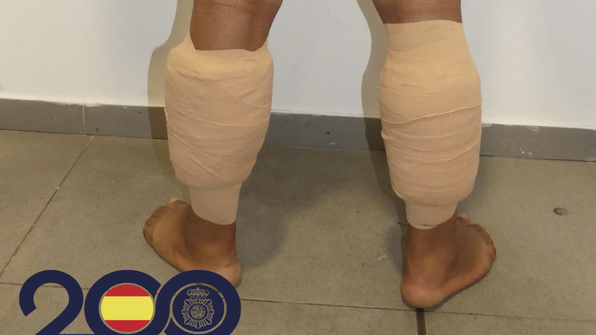 Droga enganchada con esparadrapo en las piernas de uno de los detenidos.