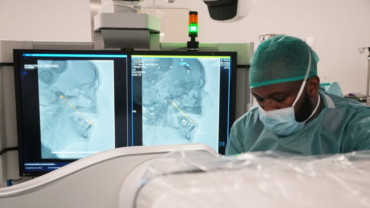 Un neurocirugiano aplicando la técnica de Mulan para aliviar el dolor de la neuralgia del trigémino.