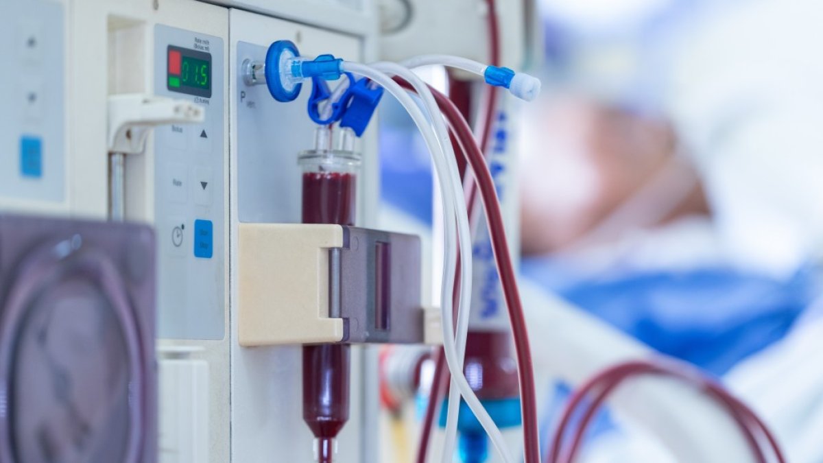 Els pacients amb aquesta malaltia han de filtrar la seva sang entre dos i quatre cops al mes.