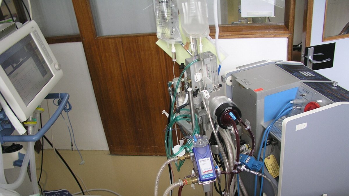 Imagen de un dispositivo ECMO