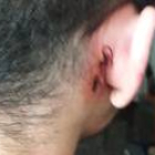 Imagen de una de las heridas causadas por el golpe con una piedra.